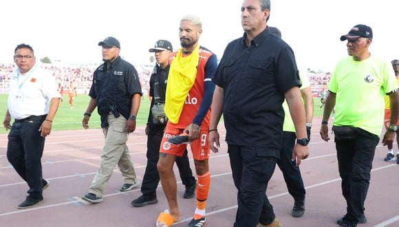 ¡Le pusieron hielo en el pie! Paolo Guerrero salió sentido de la derrota ante Sport Boys